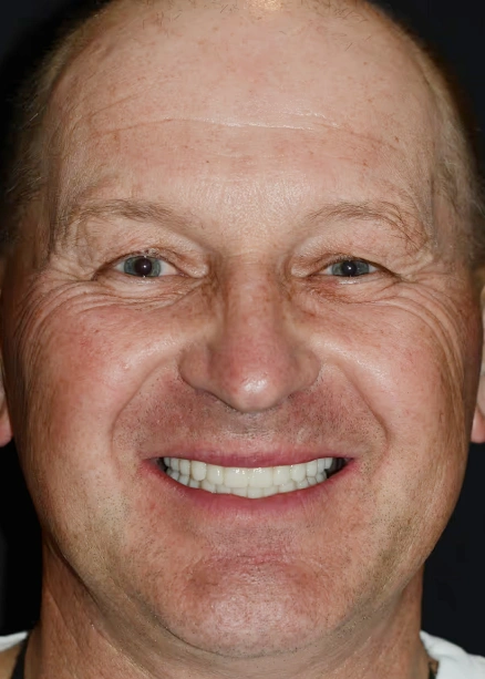 img-Real-Patients-Real-Results-one-after