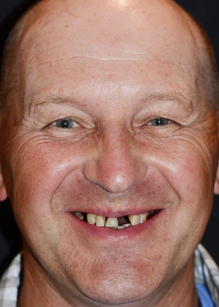 img-Real-Patients-Real-Results-one-before