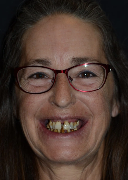 img-Real-Patients-Real-Results-one-before