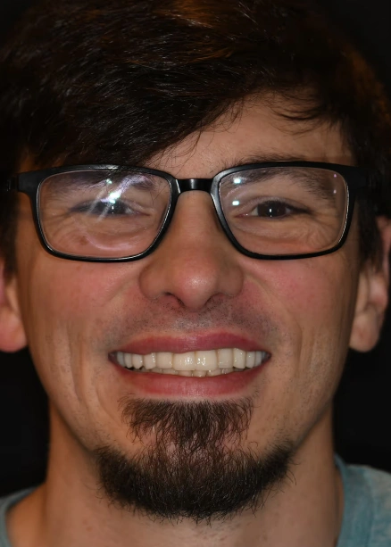 img-Real-Patients-Real-Results-six-after