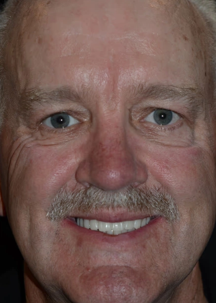 img-Real-Patients-Real-Results-three-after