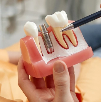Same-Day Dental Implants